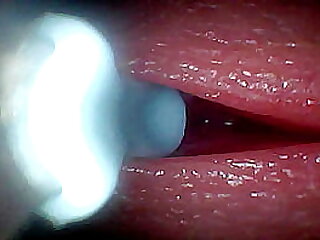 I couldn&rsquo;t believe what happens INSIDE the penis as sperm passes through &lpar;endoscopic footage&rpar;